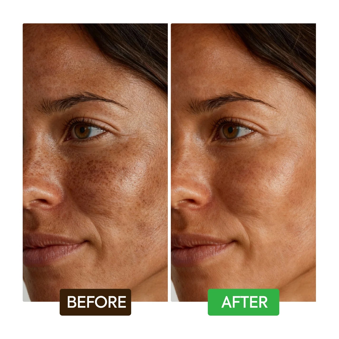 KOJIC ACID DARK SPOT REMOVER SOAP