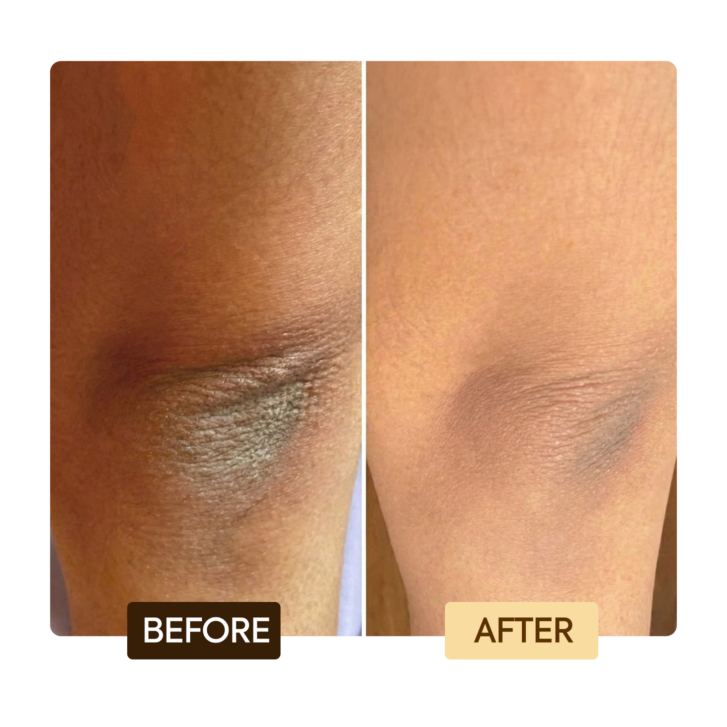 Exklusives Toning 6 Geschenkset