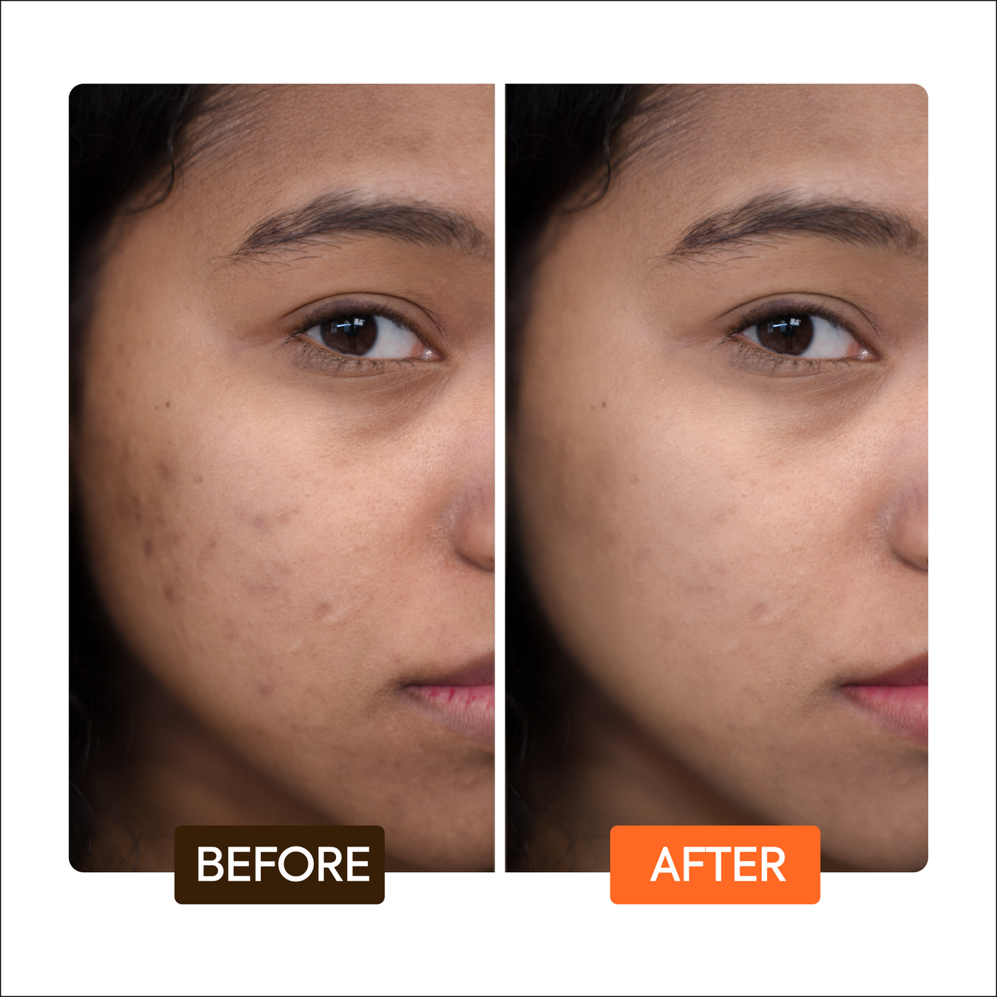 Extreme Active Intense Tone Boosting Gesichtscreme-Duo