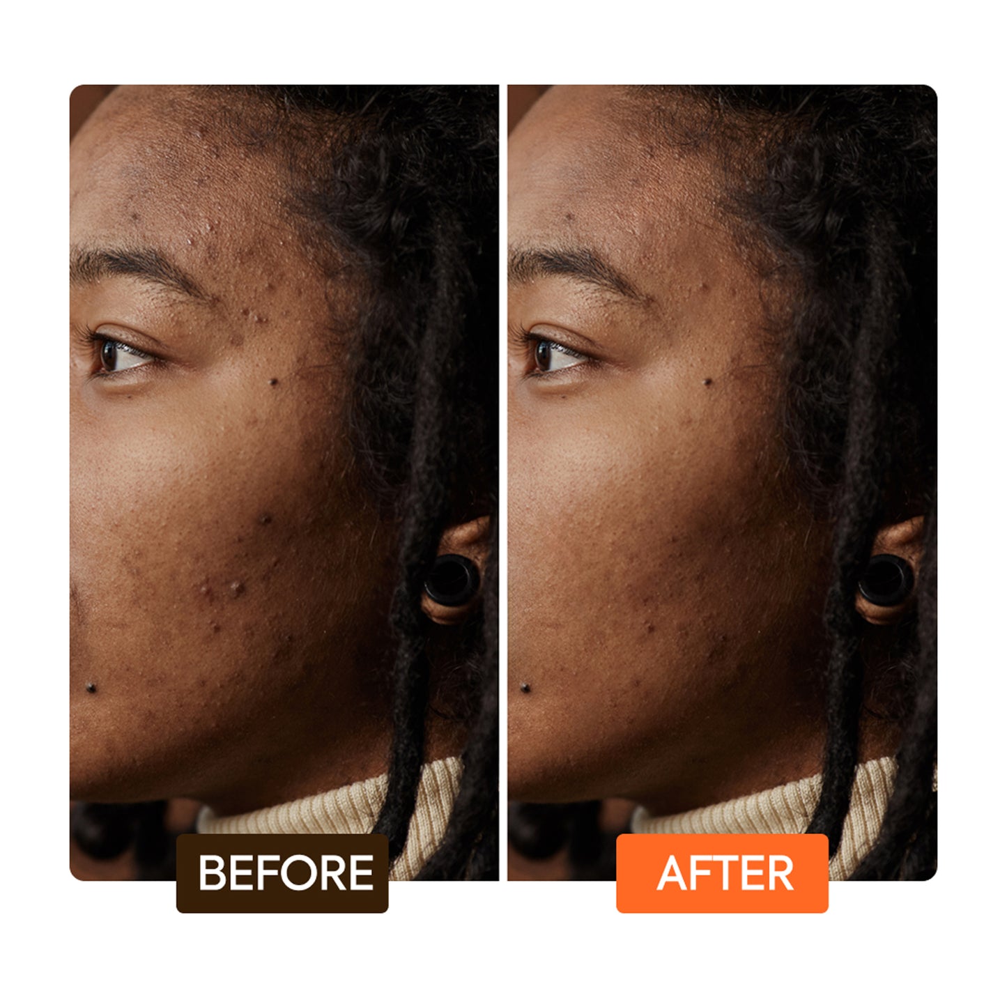 Extrem straffendes Serum mit Argan- und Karottenöl