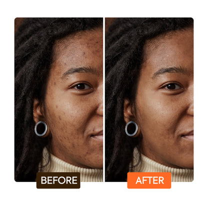 Extreme Argan- und Karotten-Peeling-Seife