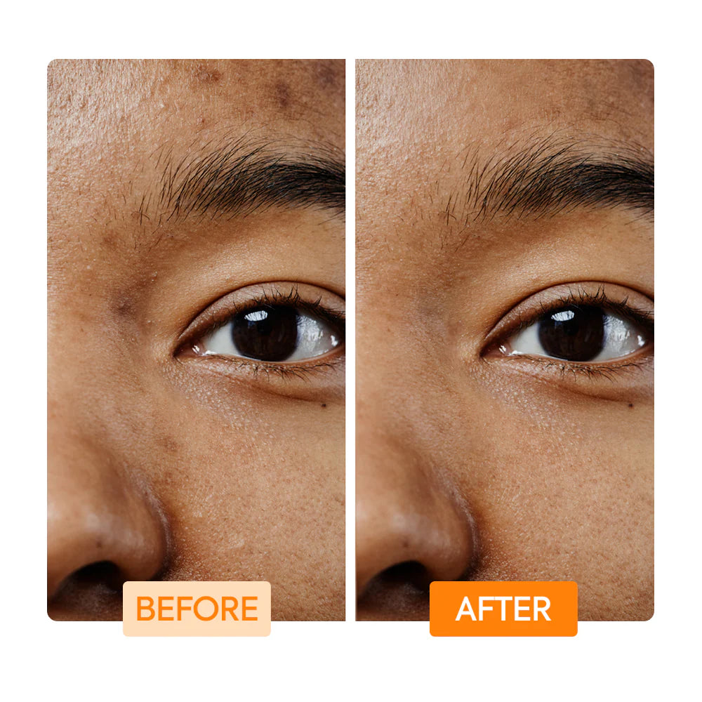 VITAMIN C + TURMERIC BODY TONING CREAM