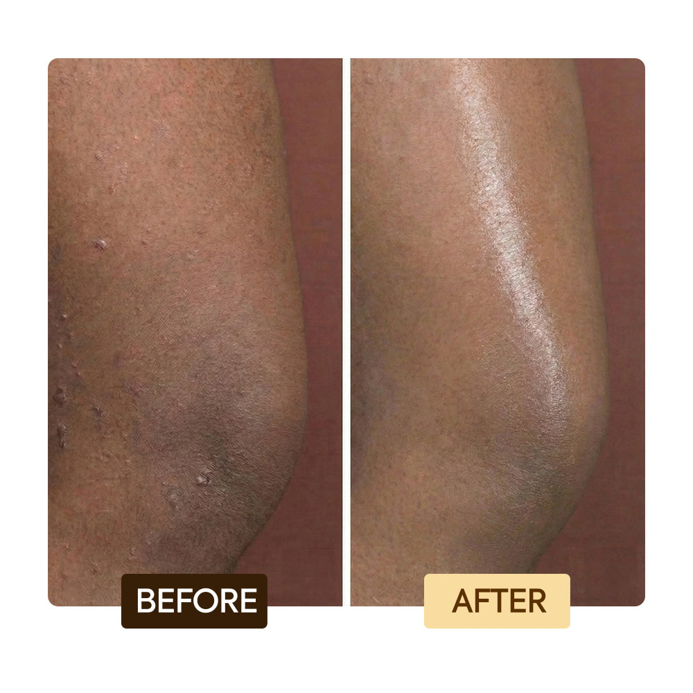Clarifying Exclusive Toning Set Unify Skin Tone