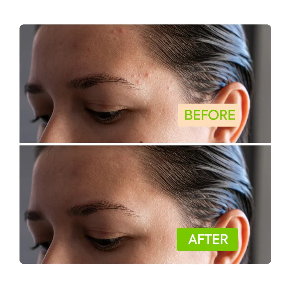 Dermatologist tested ginger cleansing bar sustainable