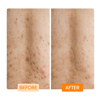 Gently Exfoliate with Lactic Acid Niacinamide Body Wash