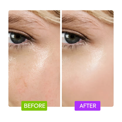 Glycolic and lactic acid face serum with fruit extract